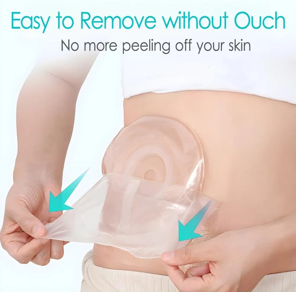 8" x 8" Ostomy Shower Cover [Pack of 50], Ostomy Bag Shower Protector Stoma Shower Guard Colostomy Shower Shields Waterproof Bandage for Women Men Showering