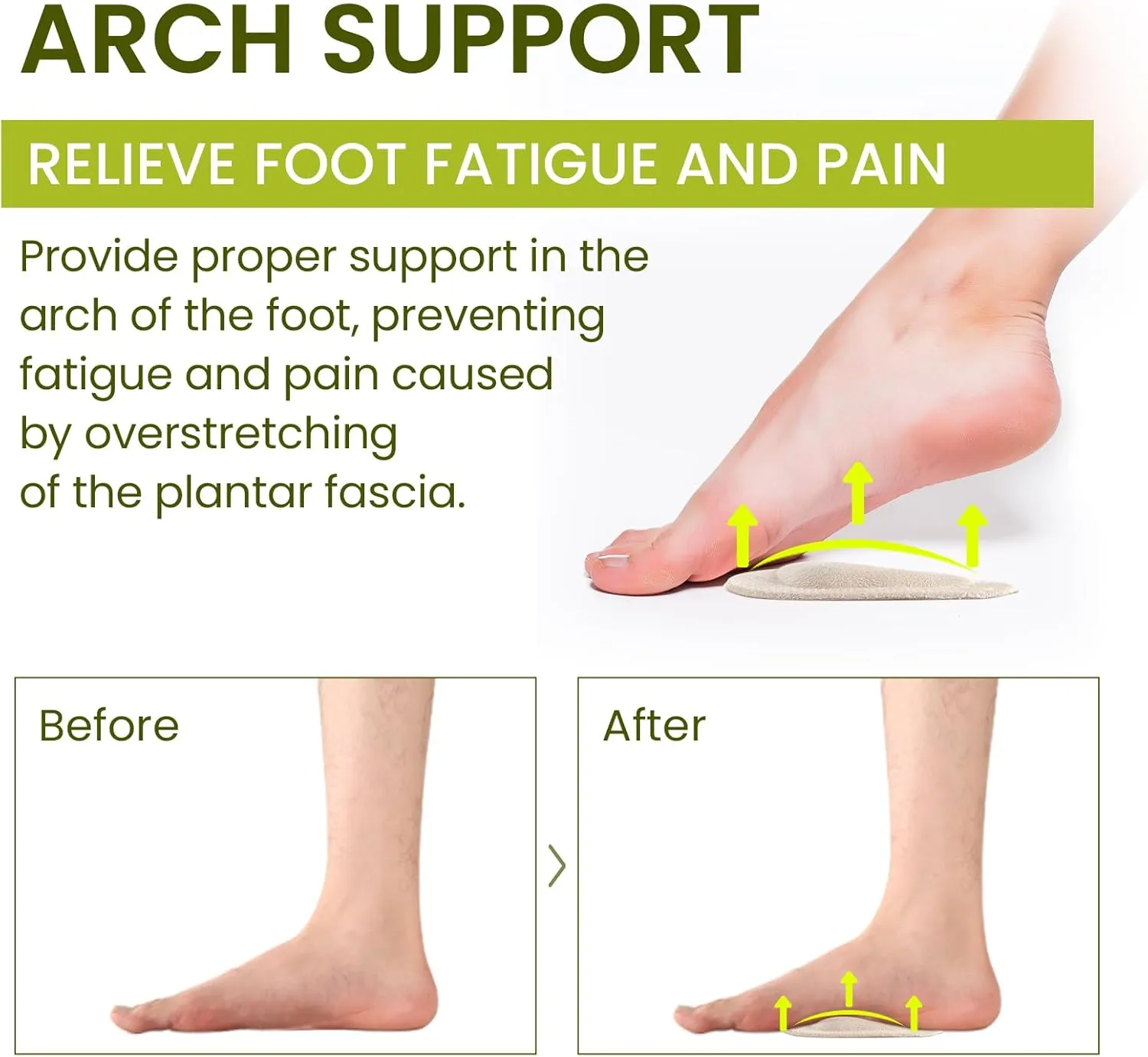 Arch Support Shoe Insoles & Insert - Bukihome Gel Arch Inserts for Flat Feet, Plantar Fasciitis - Adhesive Arch Pad for Foot Pain Relief - All Day Comfort - 0.47 Inch - 8 Pairs (Beige)